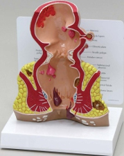 Rectum Pharmaceutical and Anatomical Model Gifts